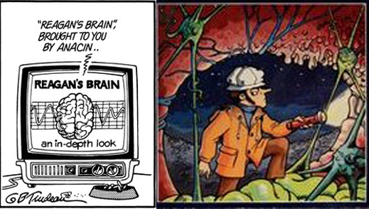 reigan's brain2